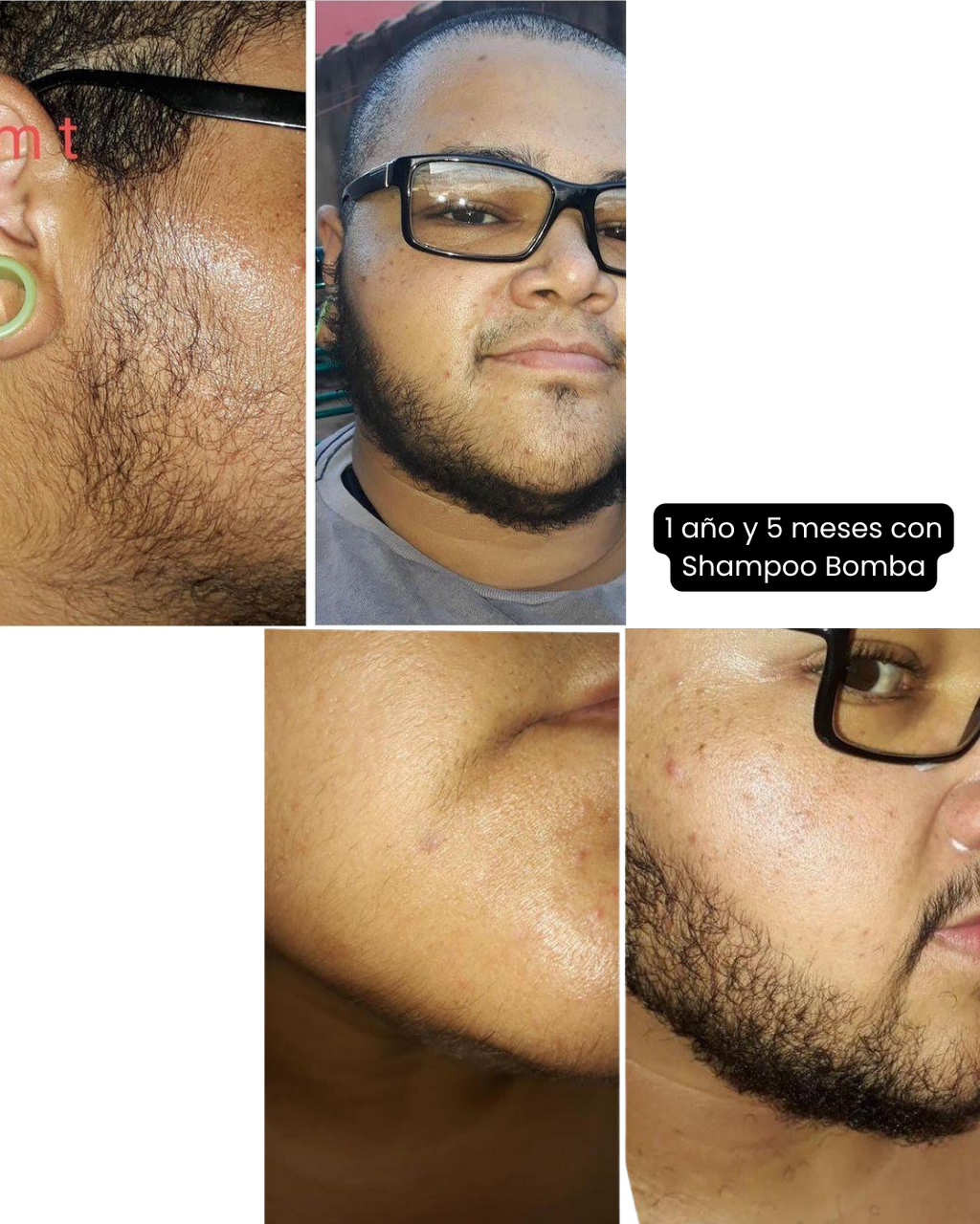 Shampoo Bomba