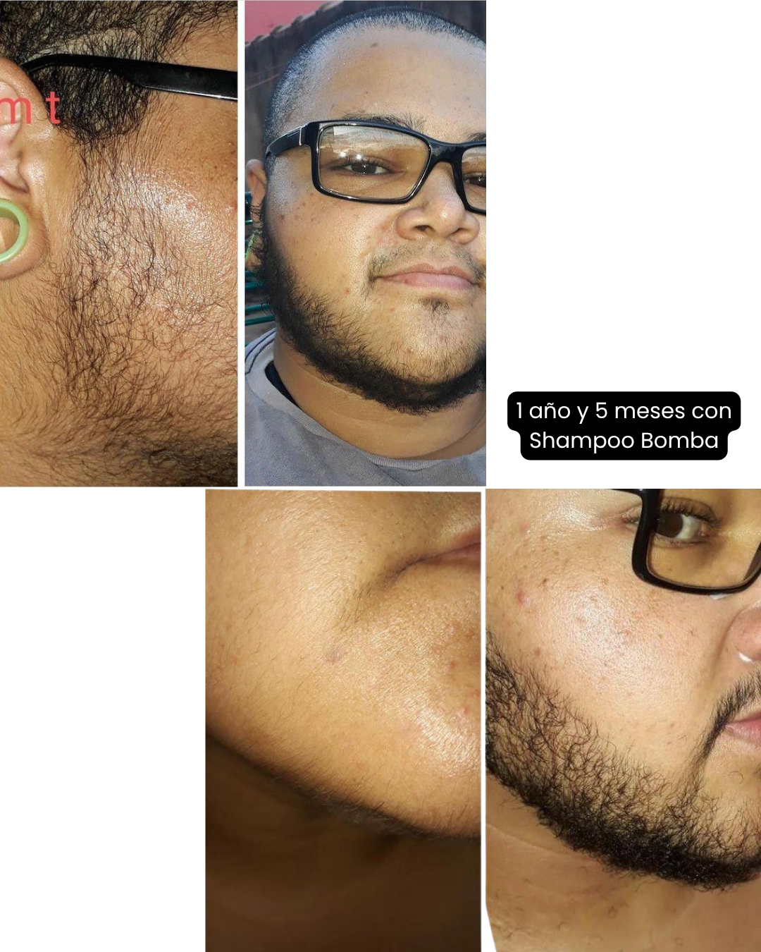 Shampoo Bomba